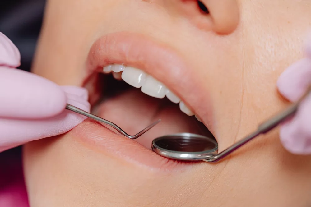 Dental Prophylaxis: Your Essential Guide to a Healthy, Sparkling Smile